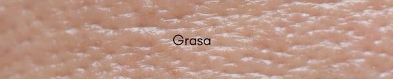 Piel grasa