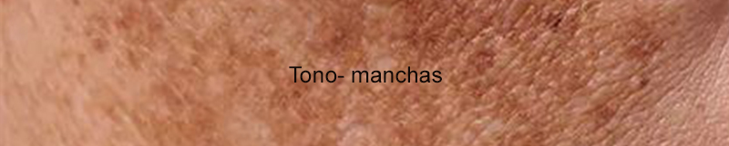 Tono disparejo